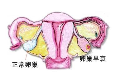 女性卵巢早衰做什么检查